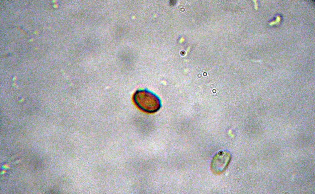 Inocybe (forse) con micro